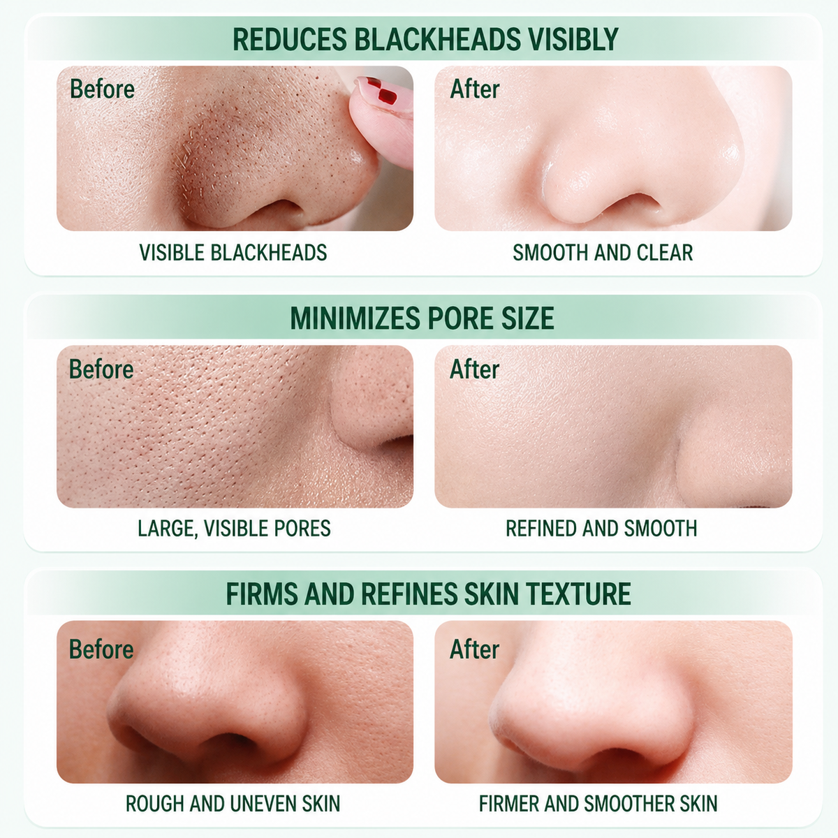 before and after pore care results