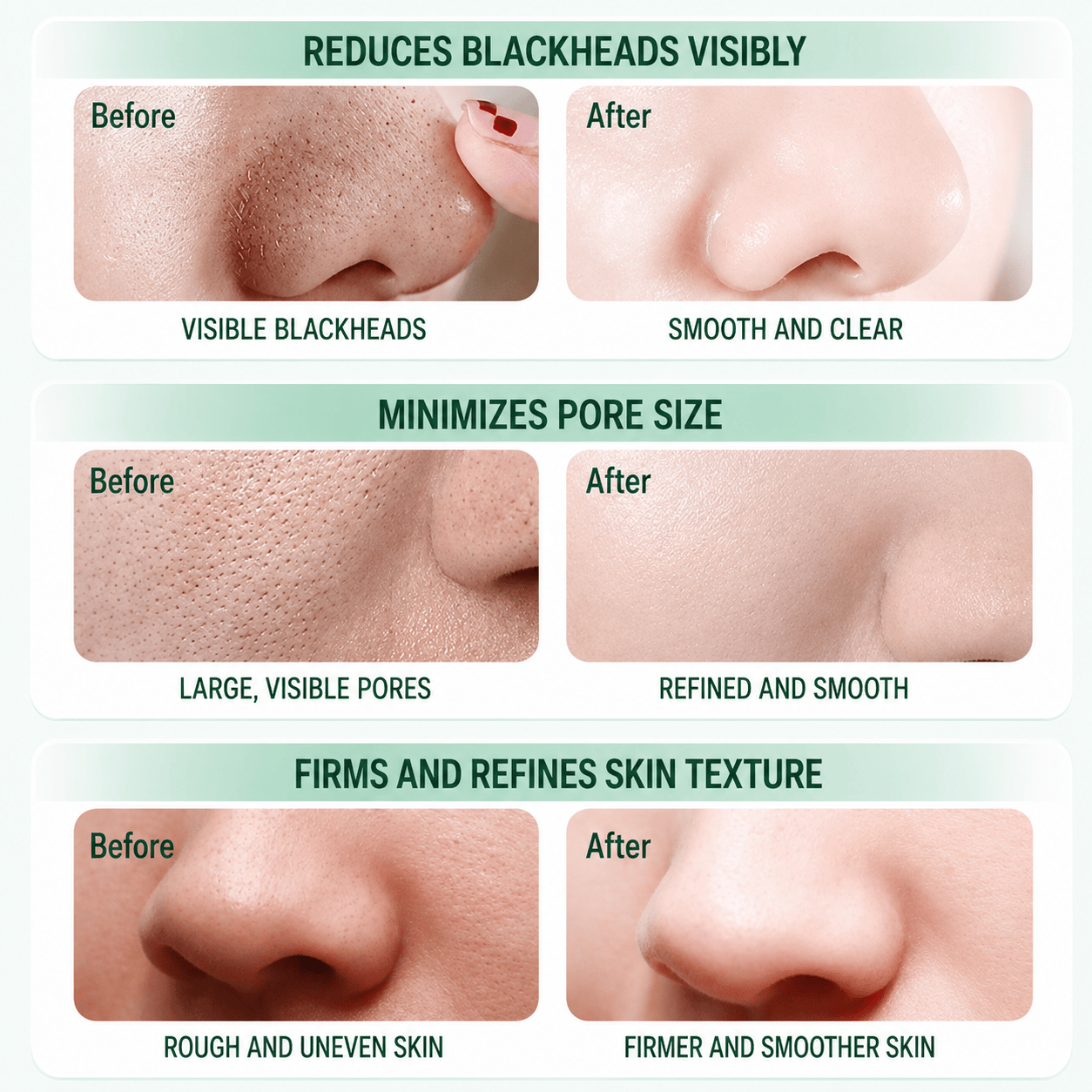 Pore Cleansing Bubble Nose Mask